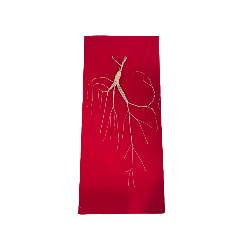 亿亩秀——25年野生林下参